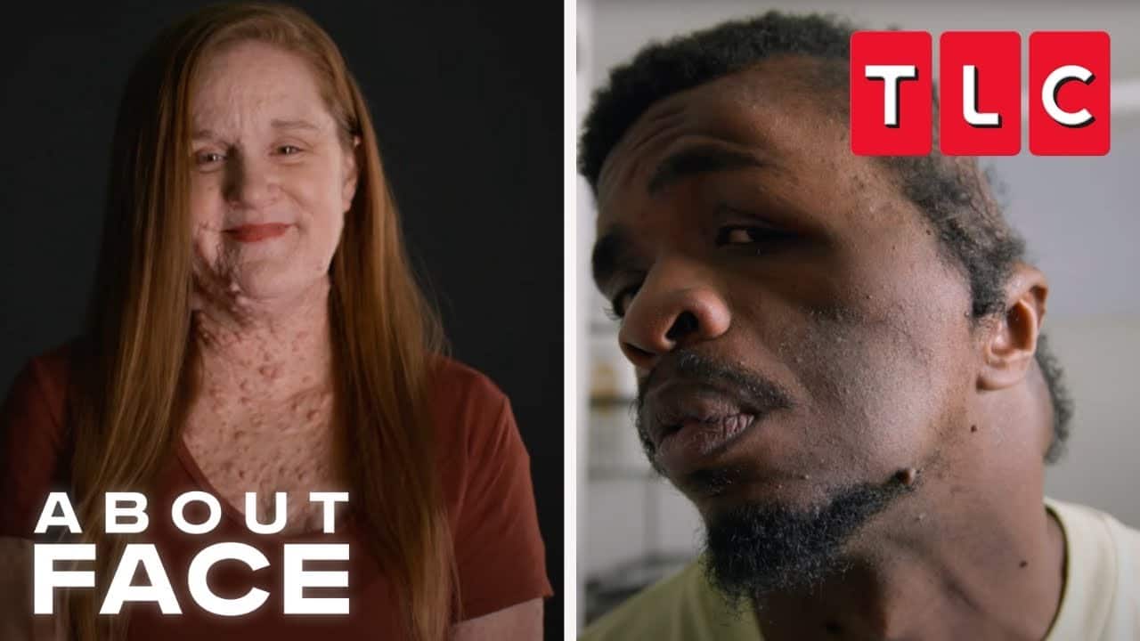 About Face “Marked at Birth” S1E2 November 5 2025 on TLC