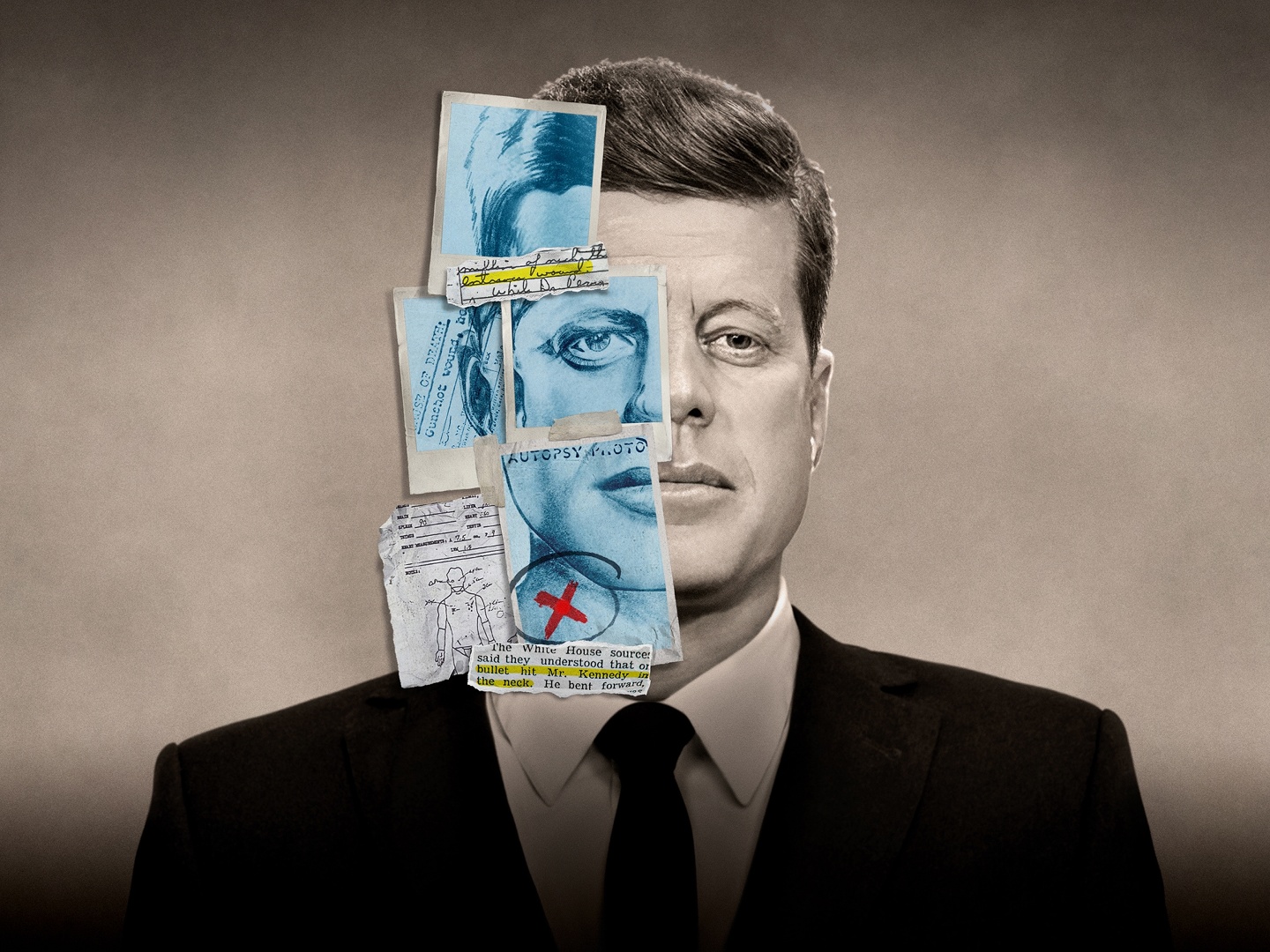 Jfk Assassination: What Happened in the Trauma Room? 19 November 2023 on Channel 5 1 Jfk Assassination: What Happened in the Trauma Room? 19 November 2023 on Channel 5